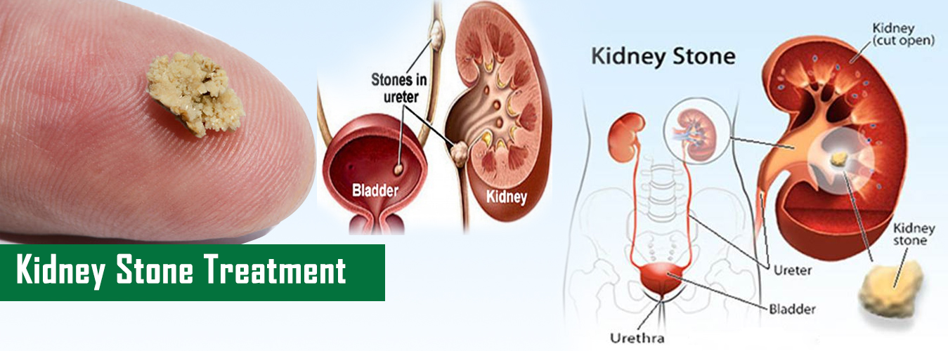 uro-oncology